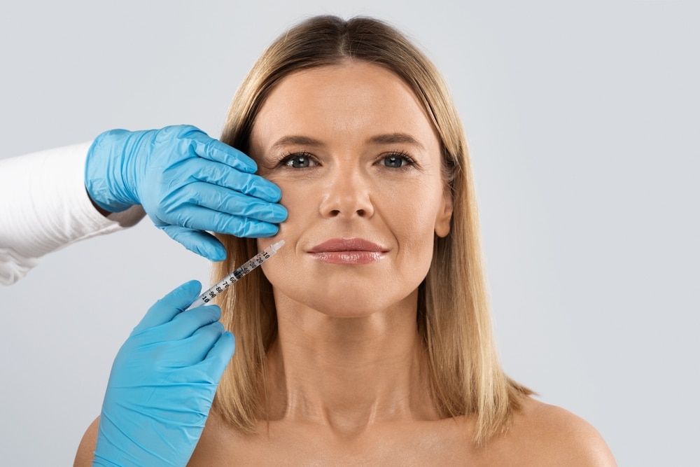 Middle-aged woman receiving RHA fillers around her mouth to treat dynamic wrinkles.