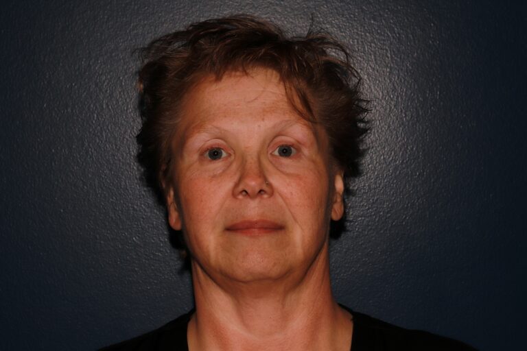 Before Image: BBL + MOXI - front